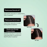 Henzo Care Dandruff-Free Shampoo