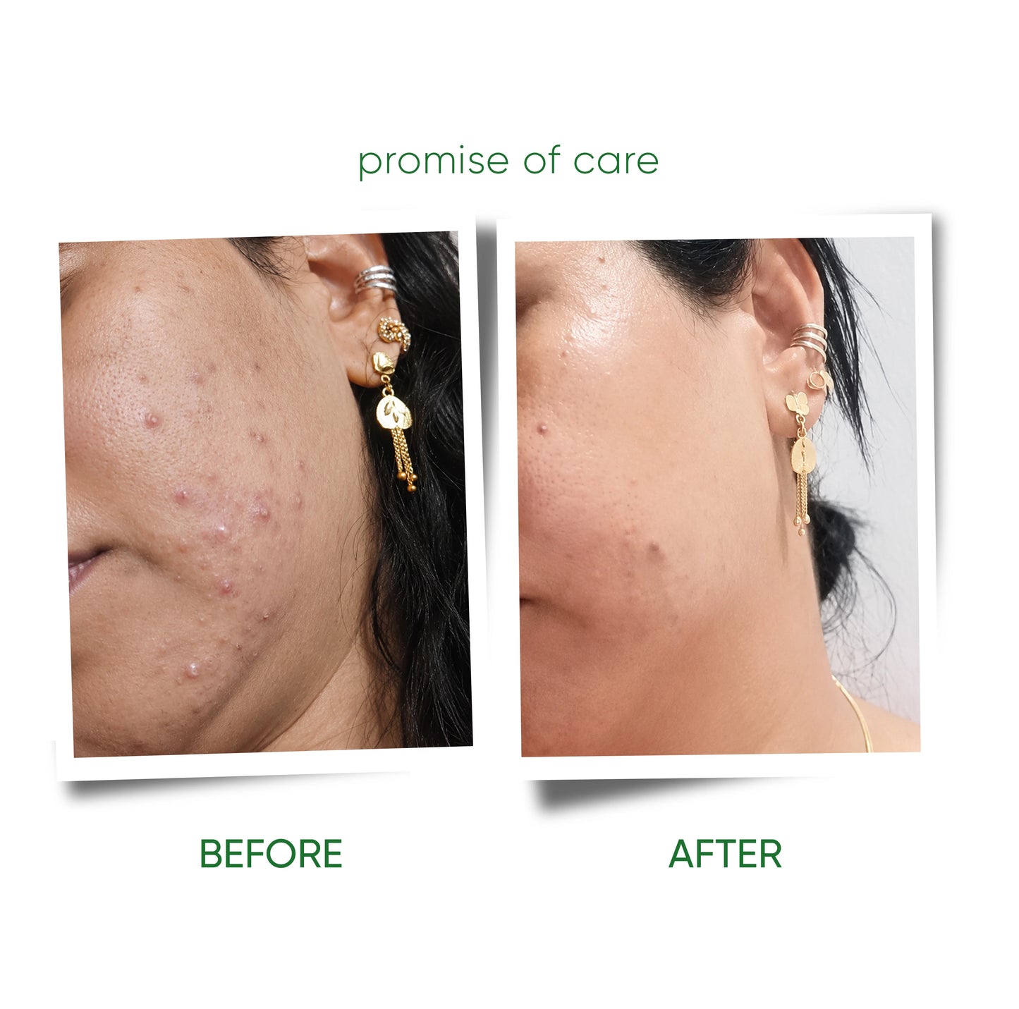 HENZOCARE FOAMING FACEWASH | 100ml