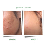 HENZOCARE FOAMING FACEWASH | 100ml