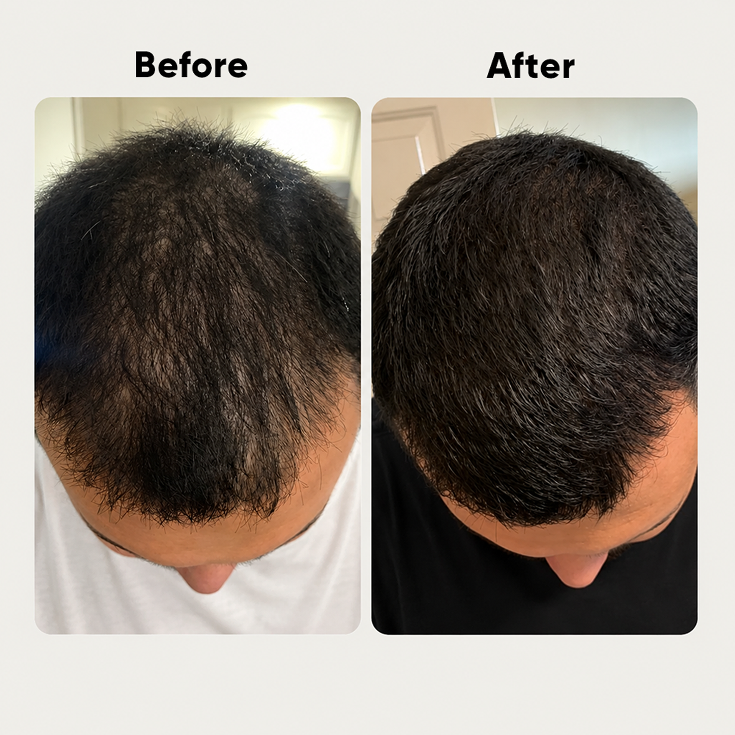 Henzocare Ayurvedic Hair Growth Oil