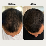 Henzocare Ayurvedic Hair Growth Oil