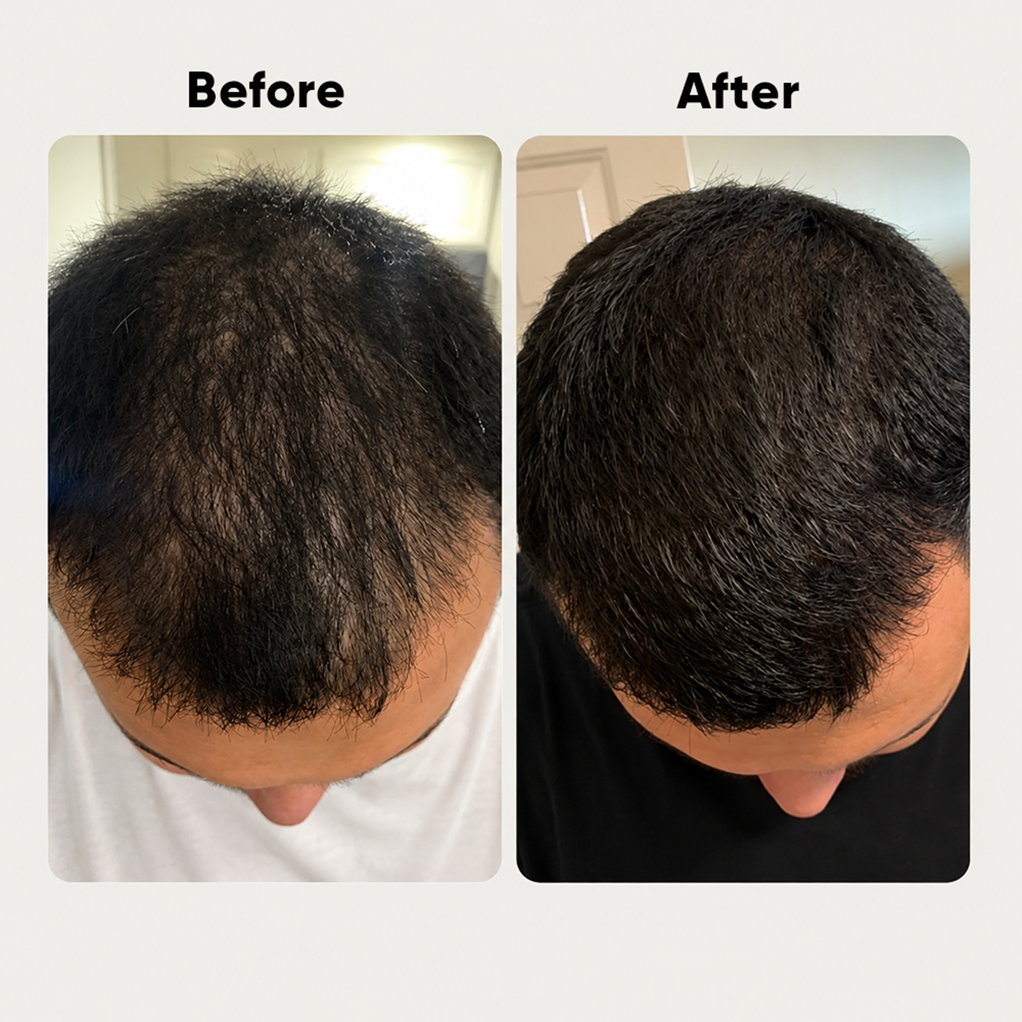 Henzocare Ayurvedic Hair Growth Oil