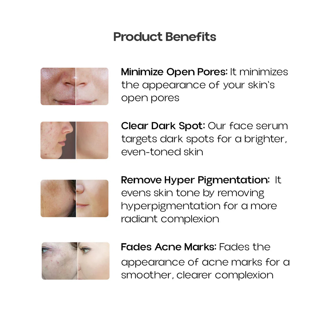 10% NIACINAMIDE FACE SERUM